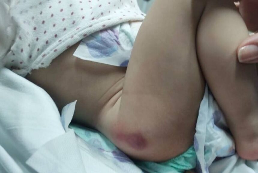 Mulher é presa por torturar filhos e maquiar os hematomas