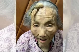 Idosa de 107 anos com chifre na testa surpreende e viraliza nas redes sociais