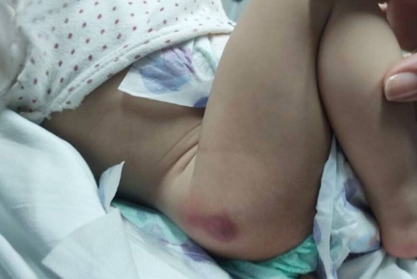 Mulher é presa por torturar filhos e maquiar os hematomas
