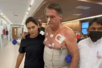 Bolsonaro apresenta melhora clínica e segue com sessões de fisioterapia