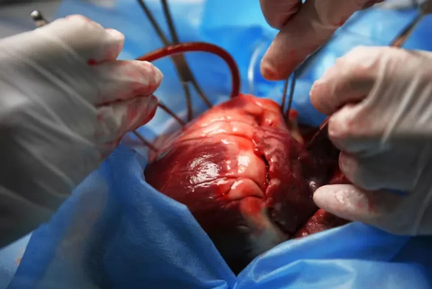 Chocante: mulher sofre ruptura da aorta durante orgasmo: 'Dor parecia facadas'