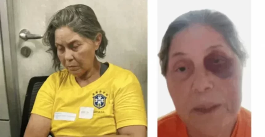 Laudo confirma que idosa presa no dia 8 de janeiro foi agredida na penitenciária