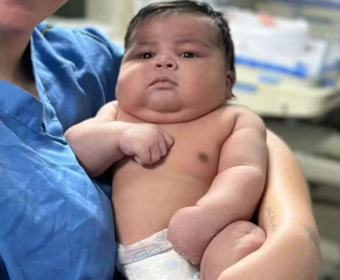 Parto de bebê gigante de 6,5 kg no Espírito Santo será investigado
