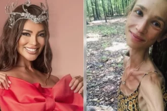 Polonesa que seguia dieta de frutas morreu pesando apenas 22 quilos