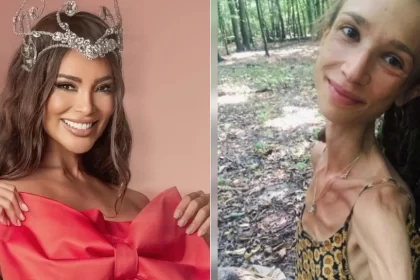 Polonesa que seguia dieta de frutas morreu pesando apenas 22 quilos