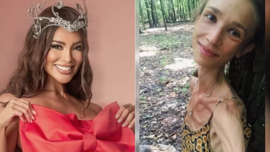 Polonesa que seguia dieta de frutas morreu pesando apenas 22 quilos