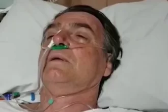 Jair Bolsonaro sofre traumatismo craniano após queda em cela na PF
