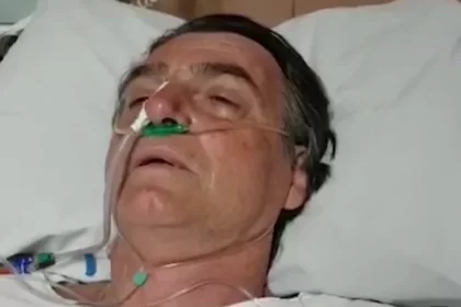 Jair Bolsonaro sofre traumatismo craniano após queda em cela na PF