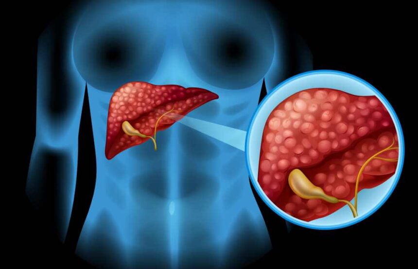 Teste experimental em animais conseguiu eliminar o câncer de pâncreas