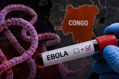 Congo registra quase 100 casos de Ebola em 24 horas com 80 mortos